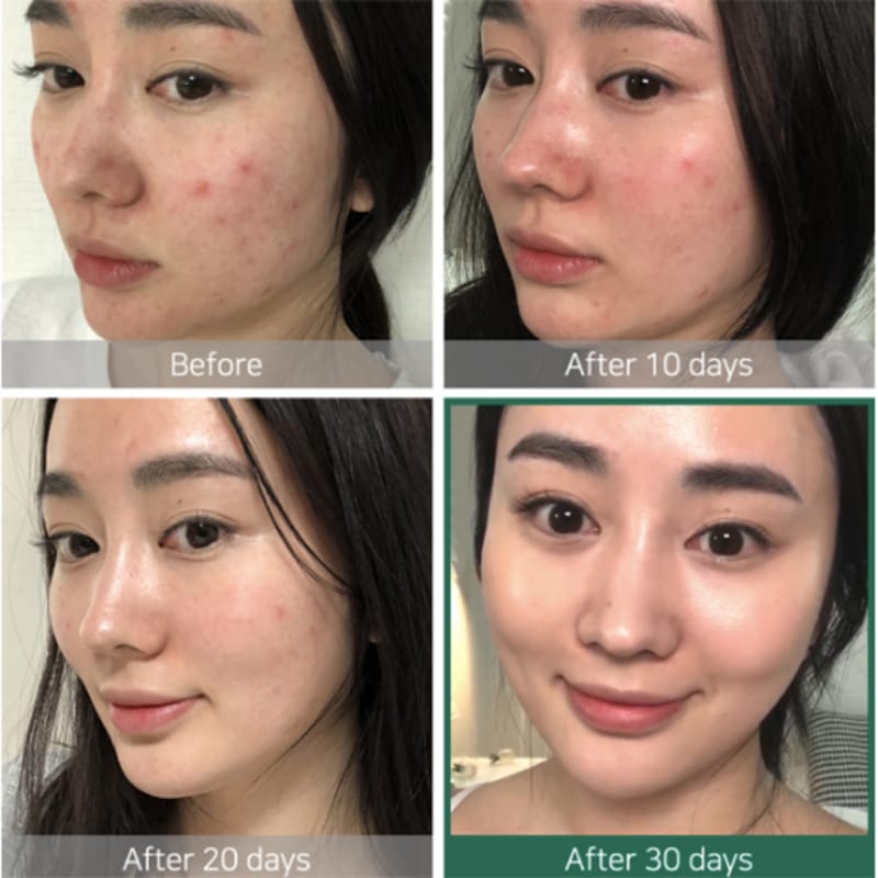 SOME BY MI AHA BHA PHA 30 Days Miracle Toner 150ML