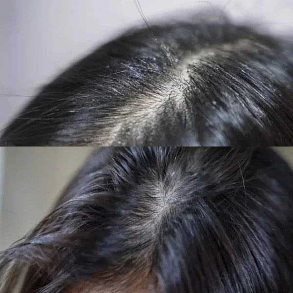 shampoo para limpieza profunda del cuero cabelludo