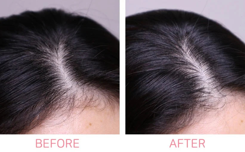 shampoo para limpieza profunda del cuero cabelludo