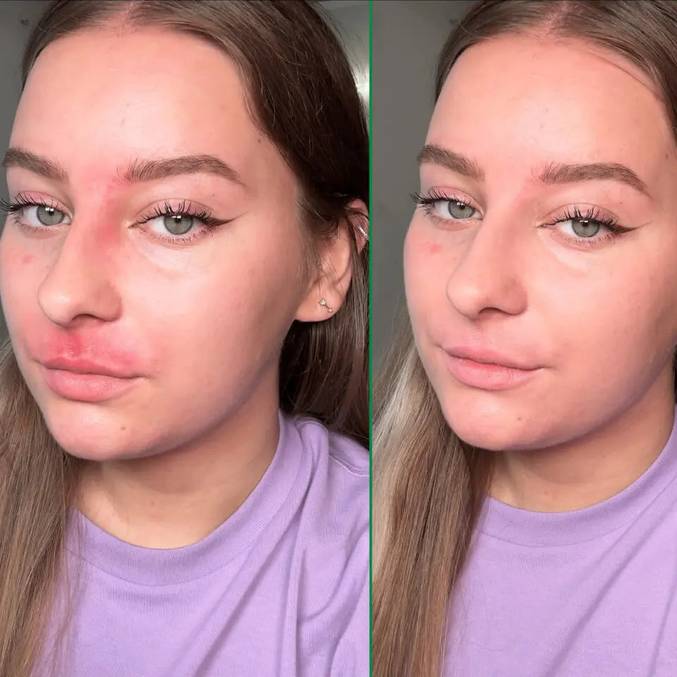 Cicapair Tiger grass color correcting treatment | DR. JART