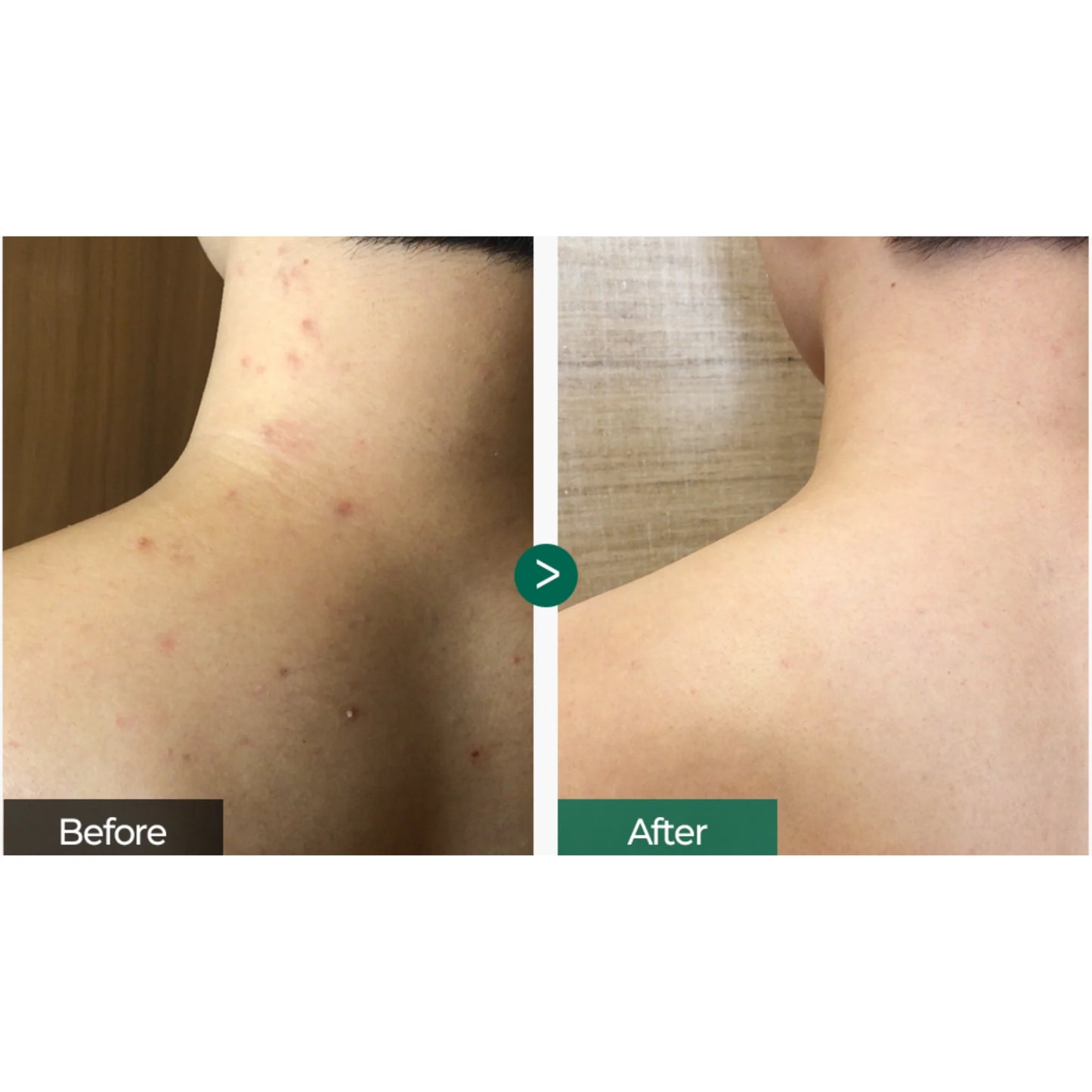 kit para cabello y cuerpo