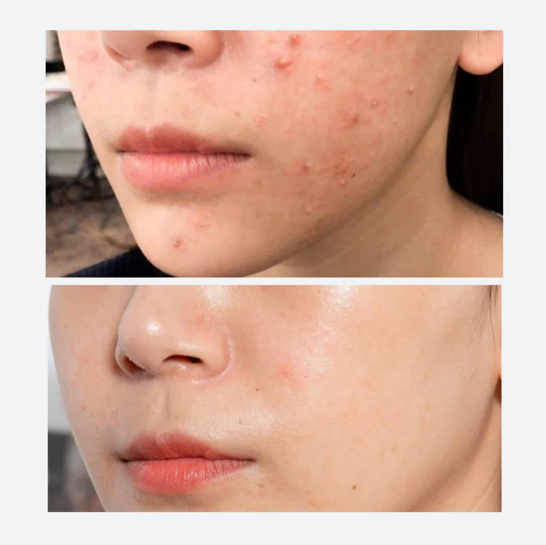 AHA.BHA.PHA 30 Days Miracle Cream | SOMEBYMI