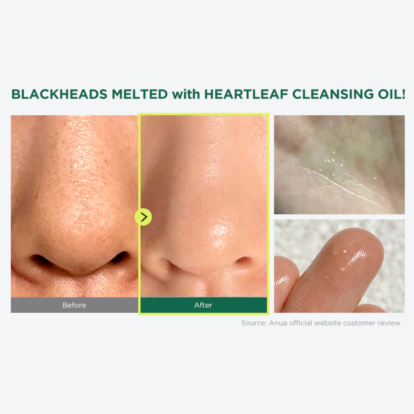 ANUA - Heartleaf Pore Control Cleansing Oil | Desmaquillante