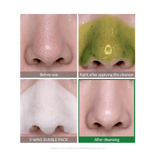 Bye Bye Blackhead 30 Days Miracle Green Tea Tox Bubble Cleanser